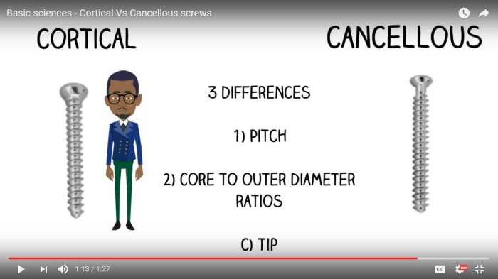 Cortical screws vs cancellous screws