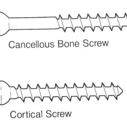 Screw cortical cancellous anatomy