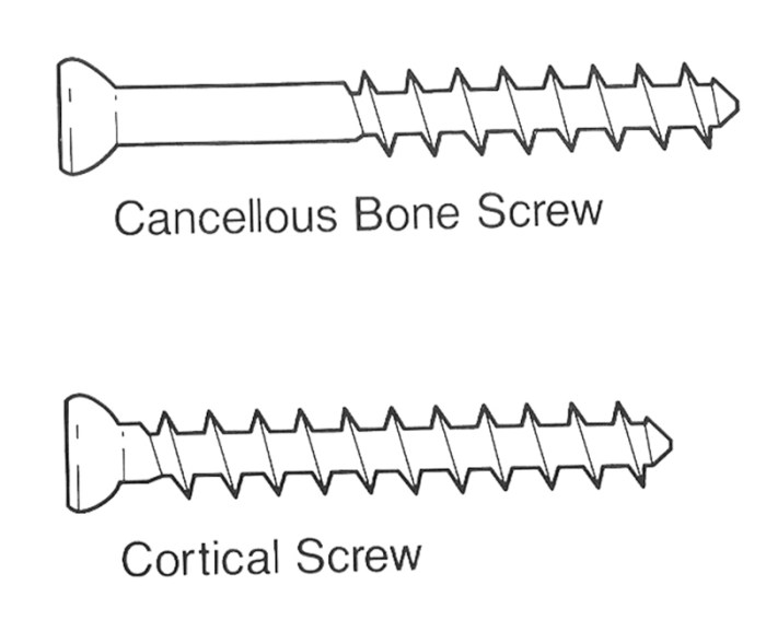 Screw cortical cancellous anatomy