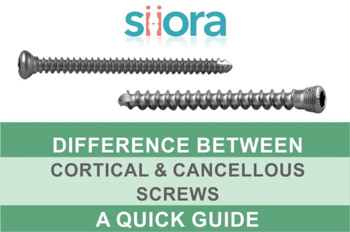 Cortical screws vs cancellous screws